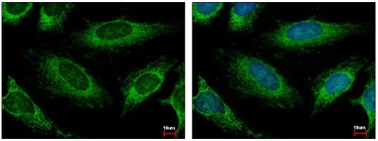 Immunocytochemistry/ Immunofluorescence - Anti-HADH antibody (AB154088)