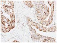 Immunohistochemistry (Formalin/PFA-fixed paraffin-embedded sections) - Anti-HADH antibody (AB154088), expandable thumbnail