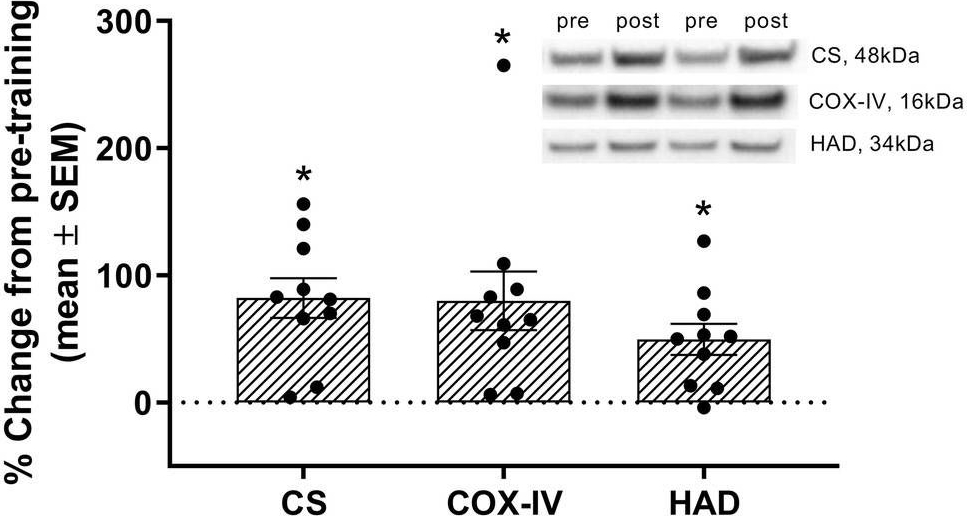 Western blot - Anti-HADH antibody (ab154088), expandable thumbnail