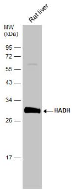 Western blot - Anti-HADH antibody (ab154088), expandable thumbnail