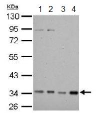 Western blot - Anti-HADH antibody (AB154088), expandable thumbnail