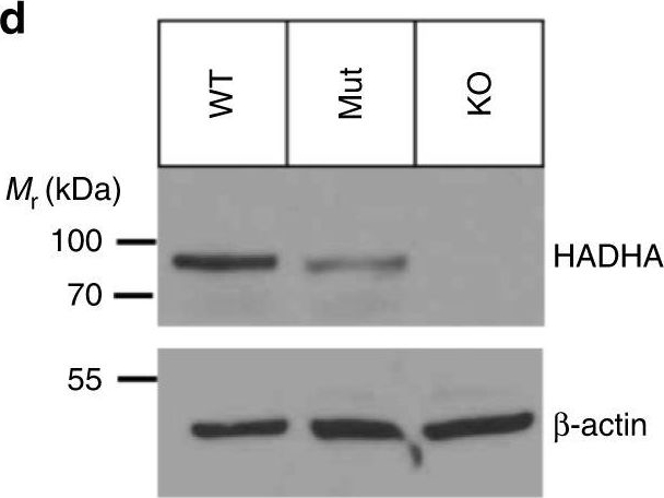 Western blot - Anti-HADHA antibody (AB54477), expandable thumbnail