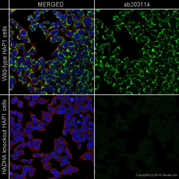 Immunocytochemistry/ Immunofluorescence - Anti-HADHA antibody [EPR17940] (AB203114)