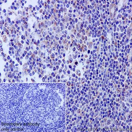 Immunohistochemistry (Formalin/PFA-fixed paraffin-embedded sections) - Anti-HADHA antibody [EPR17940] (AB203114)