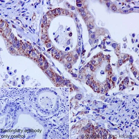 Immunohistochemistry (Formalin/PFA-fixed paraffin-embedded sections) - Anti-HADHA antibody [EPR17940] (AB203114)