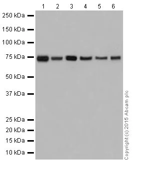 Western blot - Anti-HADHA antibody [EPR17940] (AB203114)