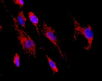 Immunocytochemistry - Anti-HADHA + HADHB antibody [4A8BG12] (AB110302)