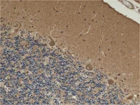 Immunohistochemistry (Formalin/PFA-fixed paraffin-embedded sections) - Anti-HADHA + HADHB antibody [4A8BG12] (AB110302)