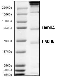 Immunoprecipitation - Anti-HADHA + HADHB antibody [4A8BG12] (AB110302)