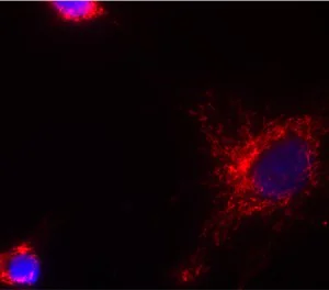 Immunocytochemistry - Anti-HADHB antibody [5C3AB7] (AB110301)