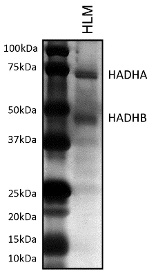 Immunoprecipitation - Anti-HADHB antibody [5C3AB7] (AB110301)