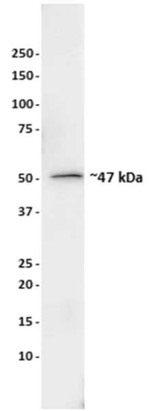 Western blot - Anti-HADHB antibody [5C3AB7] (AB110301)