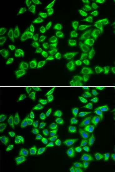 Immunocytochemistry/ Immunofluorescence - Anti-HADHB antibody (AB230667)