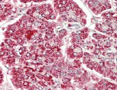 Immunohistochemistry (Formalin/PFA-fixed paraffin-embedded sections) - Anti-HADHB antibody (AB230667)
