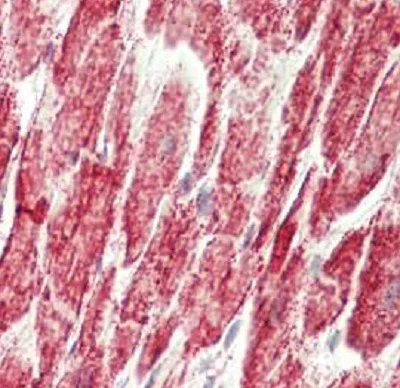 Immunohistochemistry (Formalin/PFA-fixed paraffin-embedded sections) - Anti-HADHB antibody (AB230667)