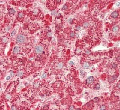 Immunohistochemistry (Formalin/PFA-fixed paraffin-embedded sections) - Anti-HADHB antibody (AB230667)