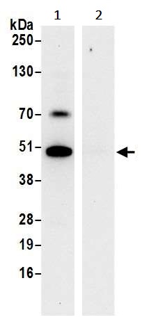 Immunoprecipitation - Anti-HADHB antibody (AB240601), expandable thumbnail