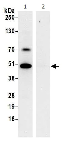 Immunoprecipitation - Anti-HADHB antibody (AB240601)