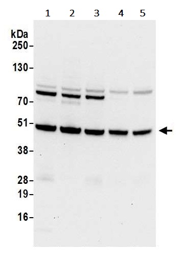 Western blot - Anti-HADHB antibody (AB240601), expandable thumbnail