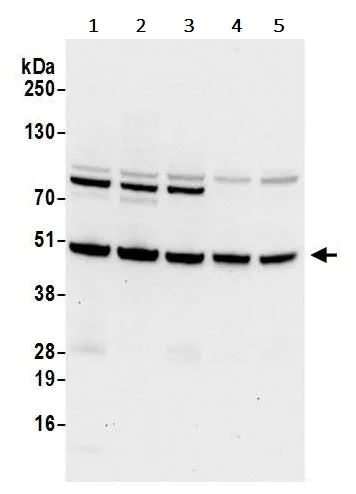 Western blot - Anti-HADHB antibody (AB240601)