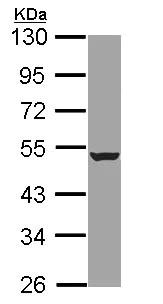 Western blot - Anti-HADHB antibody (AB96524)
