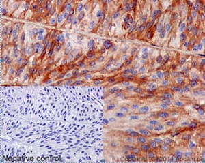 Immunohistochemistry (Formalin/PFA-fixed paraffin-embedded sections) - Anti-HAI-1 antibody [EPR15652] (AB189511), expandable thumbnail