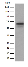Western blot - Anti-HAI-1 antibody [EPR15652] (AB189511), expandable thumbnail