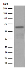 Western blot - Anti-HAI-1 antibody [EPR15652] (AB189511), expandable thumbnail