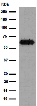 Western blot - Anti-HAI-1 antibody [EPR15652] (AB189511), expandable thumbnail