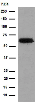 Western blot - Anti-HAI-1 antibody [EPR15652] (AB189511)