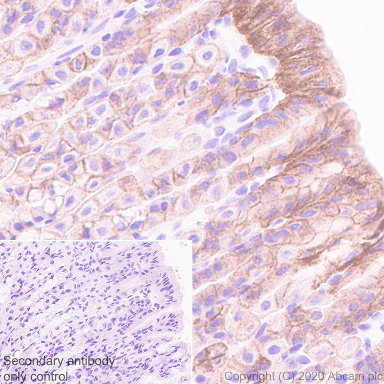 Immunohistochemistry (Formalin/PFA-fixed paraffin-embedded sections) - Anti-HAI-1 antibody [EPR23294-49] (AB272721)