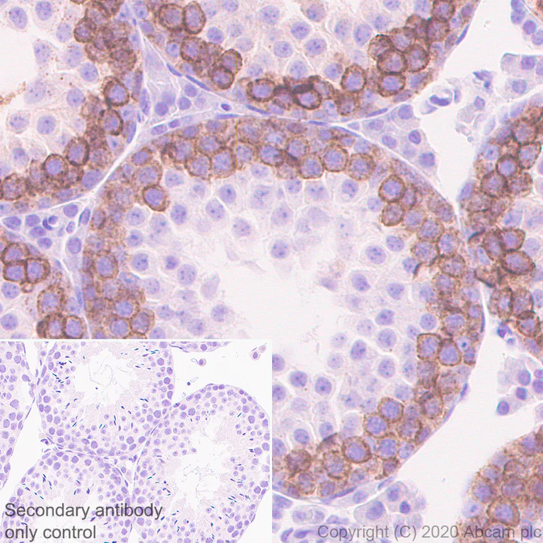 Immunohistochemistry (Formalin/PFA-fixed paraffin-embedded sections) - Anti-HAI-1 antibody [EPR23294-49] (AB272721)