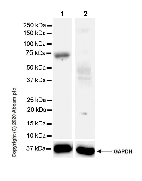 Western blot - Anti-HAI-1 antibody [EPR23294-49] (AB272721)