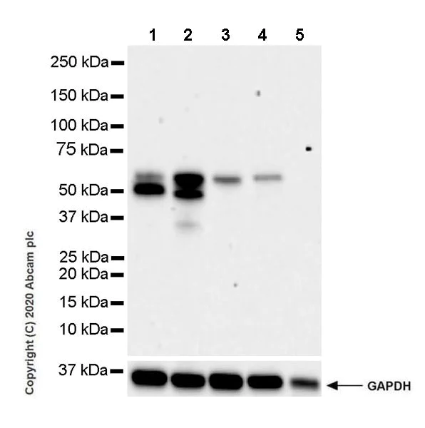 Western blot - Anti-HAI-1 antibody [EPR23294-49] (AB272721)