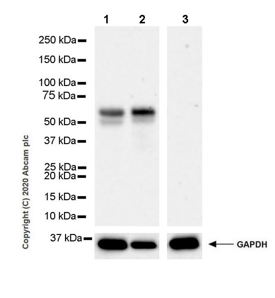 Western blot - Anti-HAI-1 antibody [EPR23294-49] (AB272721)