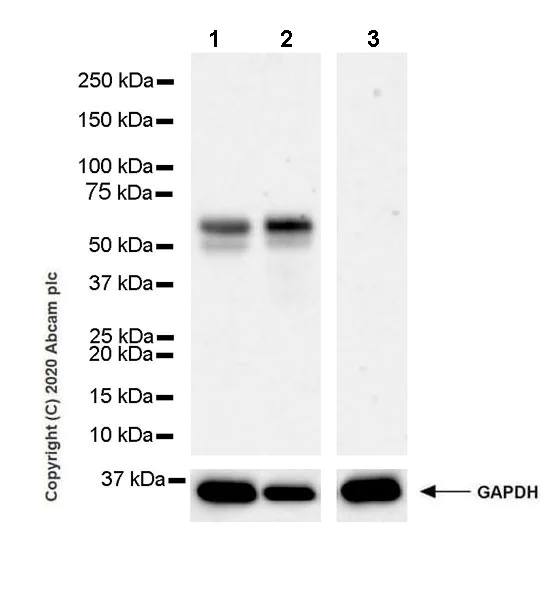 Western blot - Anti-HAI-1 antibody [EPR23294-49] (AB272721)