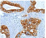 Immunohistochemistry (Formalin/PFA-fixed paraffin-embedded sections) - Anti-hair cortex Cytokeratin/K40 antibody (AB197395)