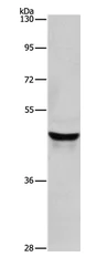 Western blot - Anti-hair cortex Cytokeratin/K40 antibody (AB197395)