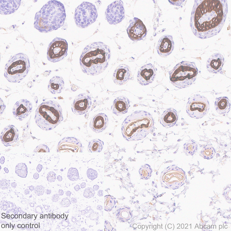 Immunohistochemistry (Formalin/PFA-fixed paraffin-embedded sections) - Anti-hair cortex Cytokeratin/K40 antibody [AE13] (AB289545), expandable thumbnail