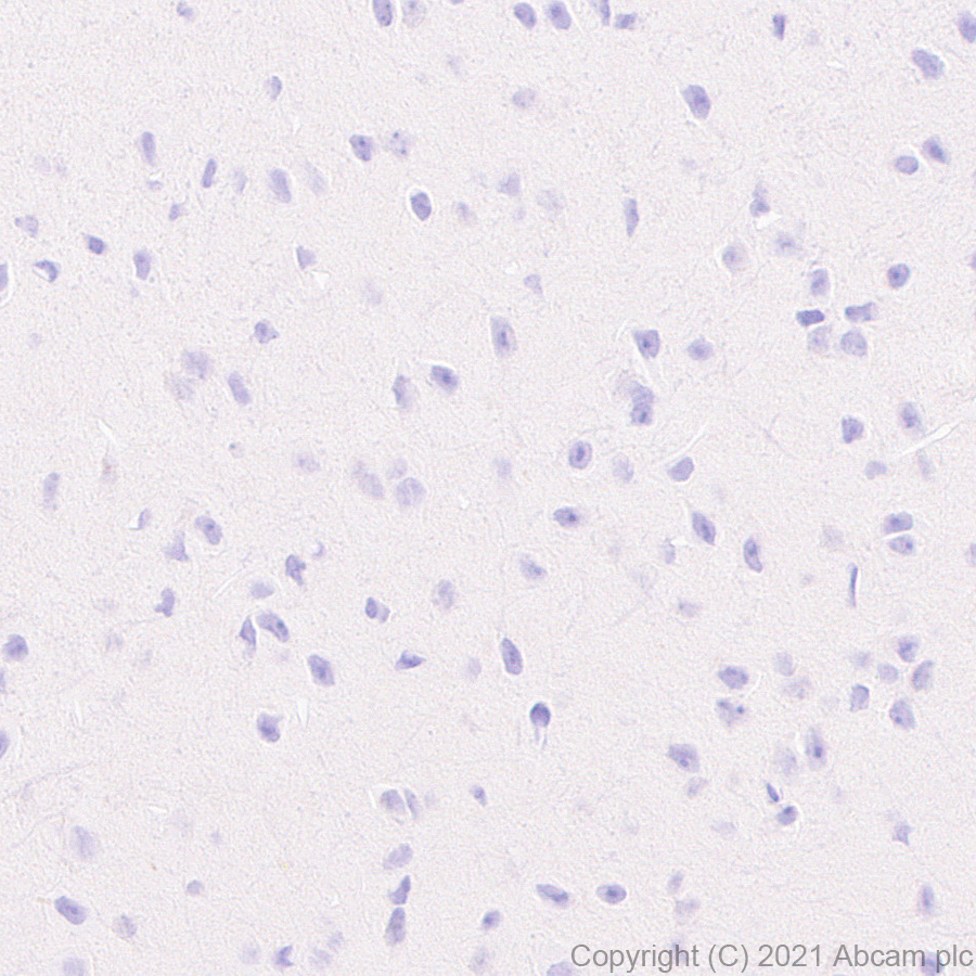 Immunohistochemistry (Formalin/PFA-fixed paraffin-embedded sections) - Anti-hair cortex Cytokeratin/K40 antibody [AE13] (AB289545), expandable thumbnail