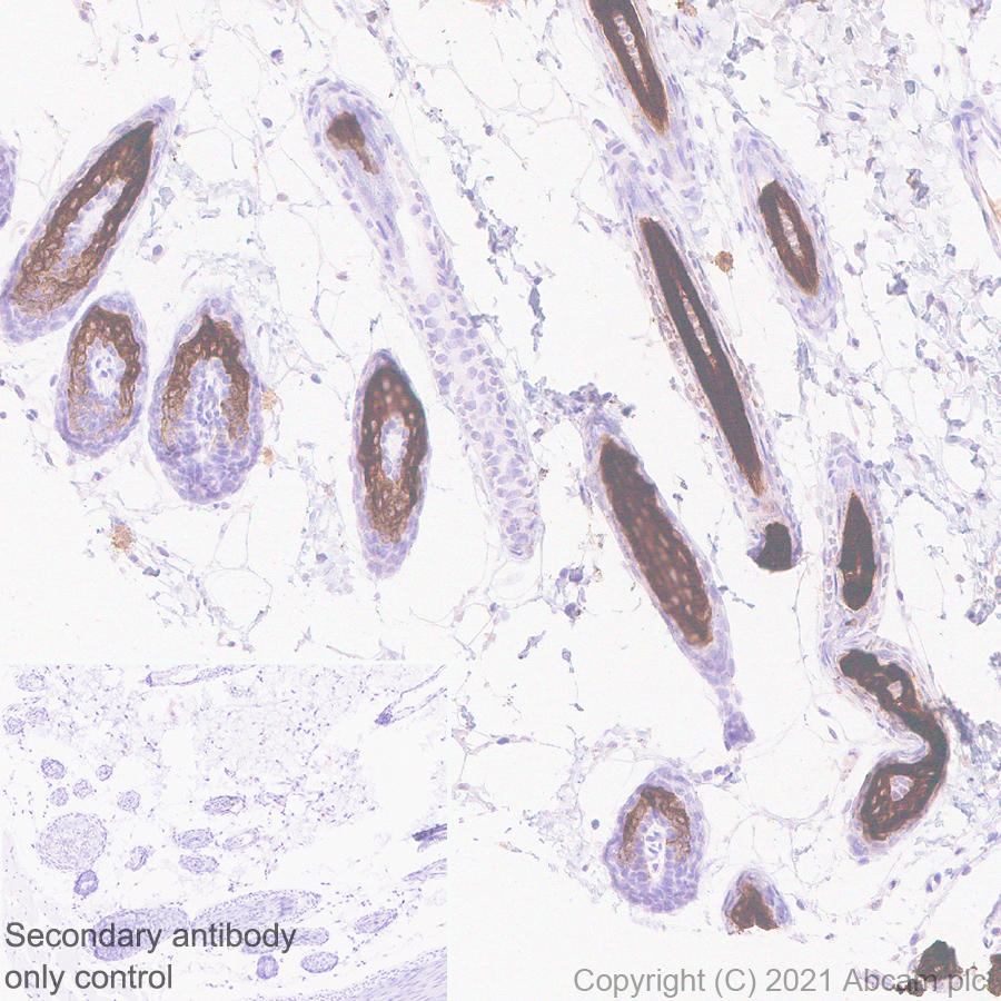 Immunohistochemistry (Formalin/PFA-fixed paraffin-embedded sections) - Anti-hair cortex Cytokeratin/K40 antibody [AE13] (AB289545), expandable thumbnail