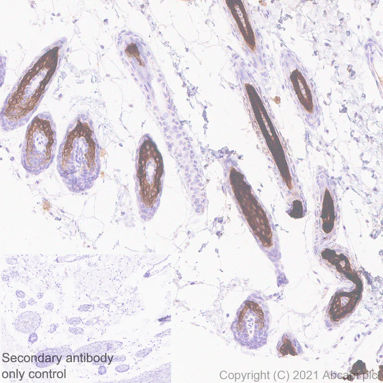 Immunohistochemistry (Formalin/PFA-fixed paraffin-embedded sections) - Anti-hair cortex Cytokeratin/K40 antibody [AE13] (AB289545)