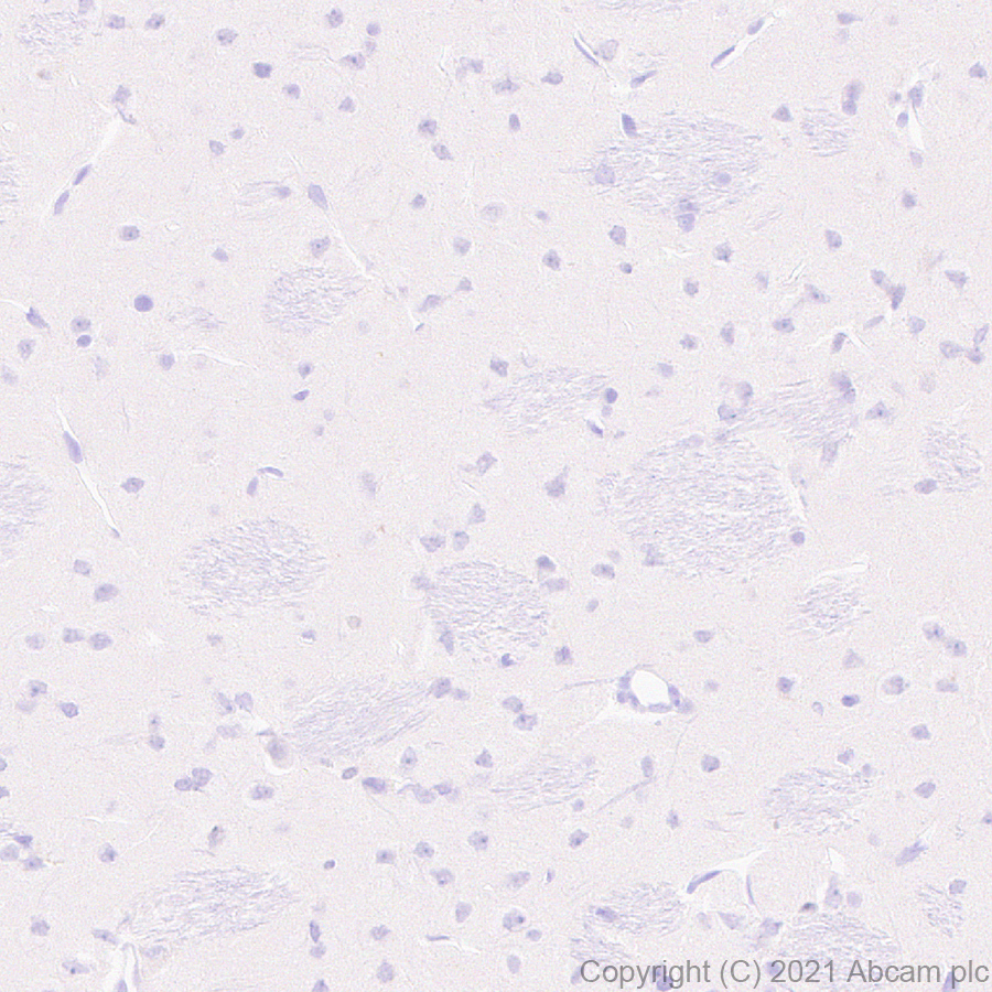 Immunohistochemistry (Formalin/PFA-fixed paraffin-embedded sections) - Anti-hair cortex Cytokeratin/K40 antibody [AE13] - BSA and Azide free (AB255963)