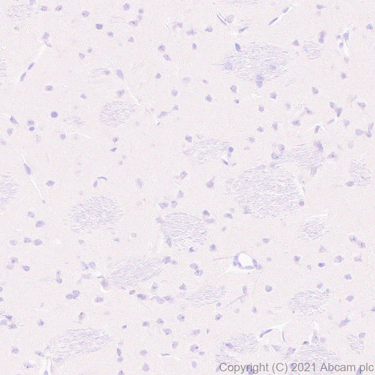 Immunohistochemistry (Formalin/PFA-fixed paraffin-embedded sections) - Anti-hair cortex Cytokeratin/K40 antibody [AE13] - BSA and Azide free (AB255963)