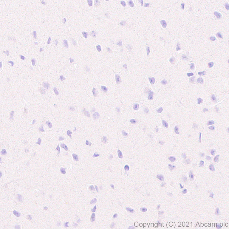 Immunohistochemistry (Formalin/PFA-fixed paraffin-embedded sections) - Anti-hair cortex Cytokeratin/K40 antibody [AE13] - BSA and Azide free (AB255963)