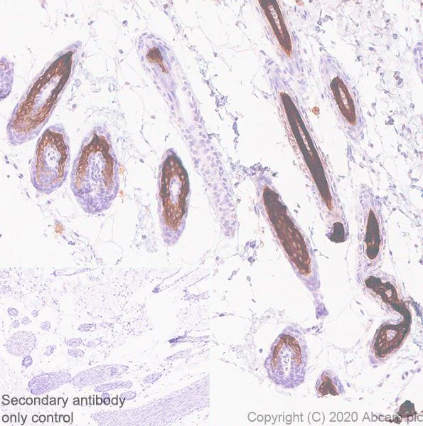 Immunohistochemistry (Formalin/PFA-fixed paraffin-embedded sections) - Anti-hair cortex Cytokeratin/K40 antibody [AE13] - BSA and Azide free (AB255963)