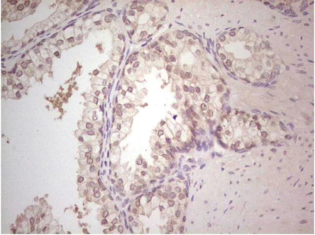 Immunohistochemistry (Formalin/PFA-fixed paraffin-embedded sections) - Anti-Hairless antibody [OTI1D9] (AB279367)