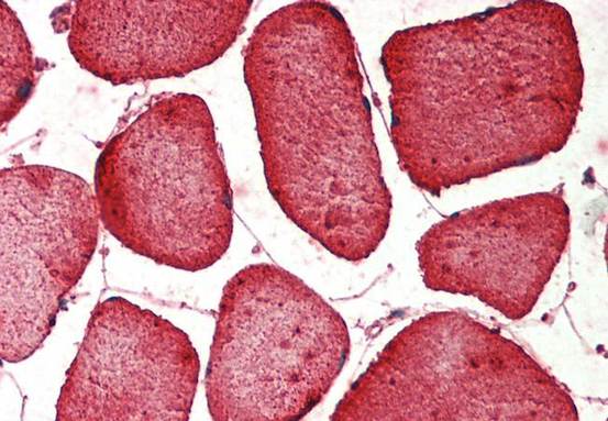 Immunohistochemistry (Formalin/PFA-fixed paraffin-embedded sections) - Anti-Hamartin antibody [357CT4.4.2] (AB211457)