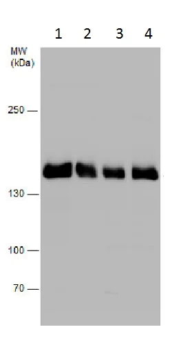Western blot - Anti-Hamartin antibody - C-terminal (AB227594)