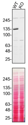 Western blot - Anti-Hamartin antibody [EP318Y] (AB40872)